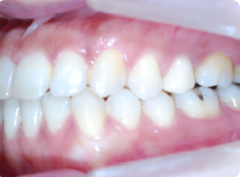 リンガル_コピー