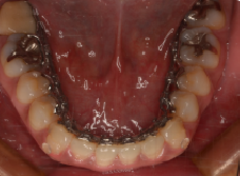 リンガル9_コピー