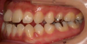 リンガル16_コピー_コピー