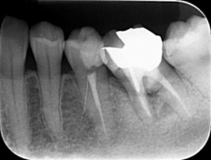 根1_コピー_コピー