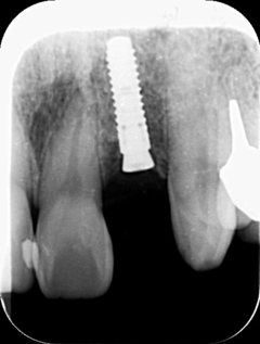 4955_313502_コピー