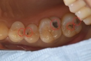 c1_コピー_コピー