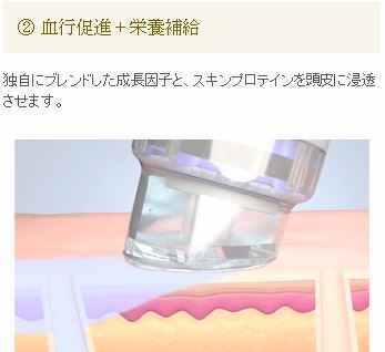 ケラビーブ2