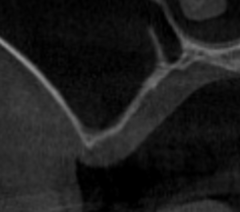 sai4_コピー_コピー