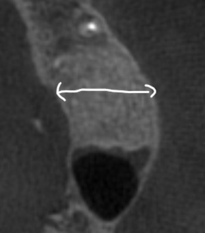 Inkedsai2_LI_コピー_コピー_コピー