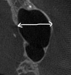 Inkedsai3_LI_コピー_コピー