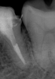 rct1_コピー_コピー_コピー