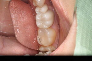 DSC_2404_コピー_コピー