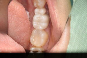 DSC_2405_コピー_コピー