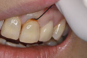 DSC_2505_コピー_コピー