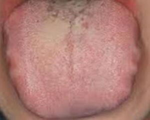 ネバネバ_コピー