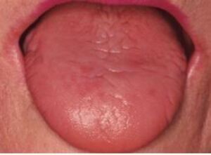 カラカラ_コピー