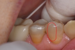 InkedDSC_2694_LI_コピー