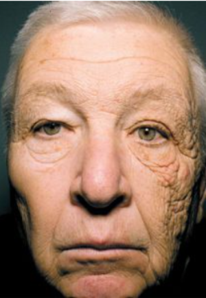 日焼け止め_コピー