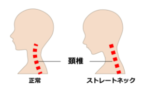 ko_コピー