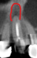 Inkeds164388132673401_LI