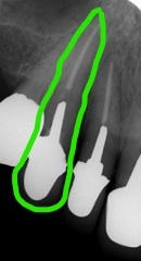 Inkeds164388133431001_LI