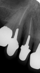 koj_コピー_コピー