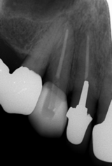 lp_コピー_コピー